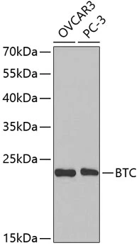 WB analysis of various sample lysates using GTX30096 Betacellulin antibody. Dilution : 1:1000 Loading : 25microg per lane WB analysis of various sample lysates using GTX30096 Betacellulin antibody. Dilution : 1:1000 Loading : 25microg per lane