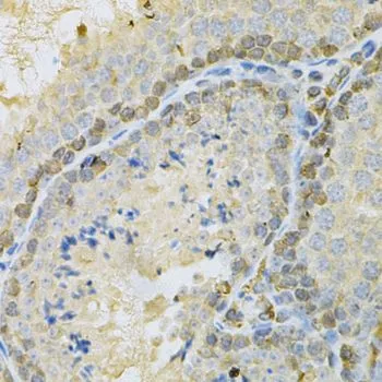 IHC-P analysis of mouse testis tissue using GTX30097 BUB1 antibody. Dilution : 1:200