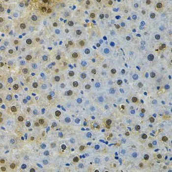 IHC-P analysis of rat liver tissue using GTX30097 BUB1 antibody. Dilution : 1:200
