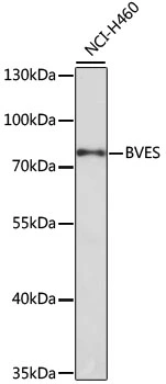 WB analysis of NCI-H460 cell lysate using GTX30098 BVES antibody. Dilution : 1:1000 Loading : 25microg per lane WB analysis of NCI-H460 cell lysate using GTX30098 BVES antibody. Dilution : 1:1000 Loading : 25microg per lane