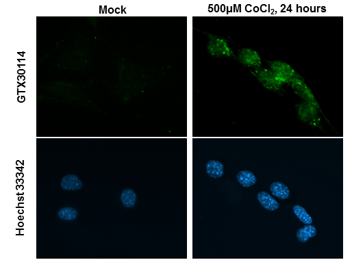 Anti-HIF2 alpha antibody (GTX30114) | GeneTex