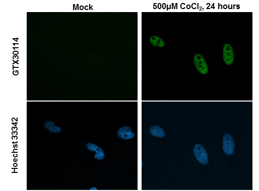 HIF2 alpha antibody detects HIF2 alpha protein at nucleus by immunofluorescent analysis. Sample: HeLa cells were fixed in 4% paraformaldehyde at RT for 15 min. Green: HIF2 alpha stained by HIF2 alpha antibody (GTX30114) diluted at 1:200. Blue: Hoechst 33342 staining.