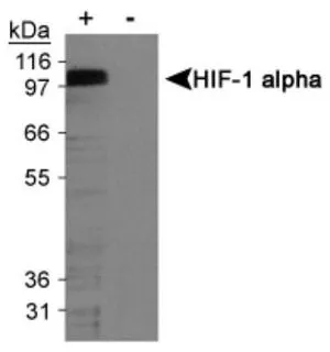 IHC-P analysis of human kidney tissue using GTX30115 HIF1 alpha antibody [H1alpha67].
