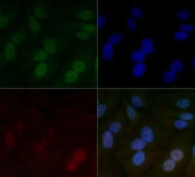 ICC/IF analysis of HeLa cells using GTX30116 HIF1 beta antibody [H1beta234]. Green : primary antibody Red : Actin Blue : DAPI Dilution : 5 microg/ml Fixation : 10% formalin Permibilization : 0.5% Triton-X100