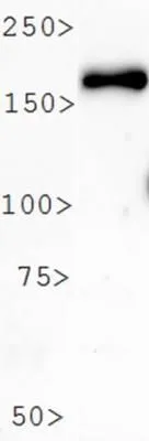 WB analysis of ARPE-19 cell lysate using GTX30117 PER2 antibody. WB analysis of ARPE-19 cell lysate using GTX30117 PER2 antibody.