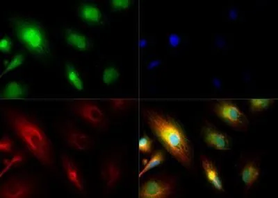 ICC/IF analysis of ARPE-19 cells using GTX30117 PER2 antibody. Green : primary antibody Red : Tubulin Blue : DAPI Dilution : 1:250