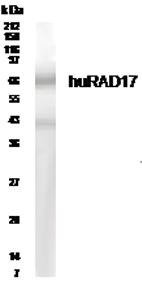 Western blot analysis of human RAD17 in heart lysate with anti-huRAD17 (GTX30134) at a 1:500 dilution. Western blot analysis of human RAD17 in heart lysate with anti-huRAD17 (GTX30134) at a 1:500 dilution.