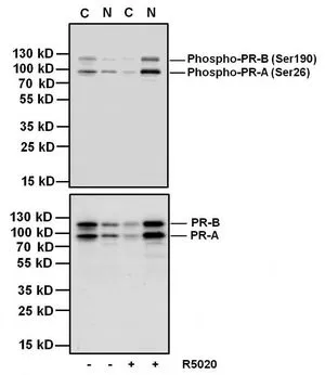 WB analysis of 20 ug of nuclear (N) or cytoplasmic (C) of T47D cell lysate untreated (-) or stimulated (+) with 100 nM promegestone (R5020) for 1 hour using GTX30164 Progesterone Receptor (phospho Ser190) antibody [1154] at 4 microg/ml (upper panel) or a Progesterone Receptor mouse monoclonal antibody (lower pane) . This antibody detects both phosphorylated isoform A and isoform B.