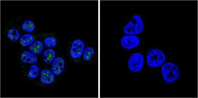ICC/IF analysis of T47D cells using GTX30164 Progesterone Receptor (phospho Ser190) antibody [1154]. Cells were probed without (right) or with(left) an antibody. Green : Primary antibody Blue : Nuclei Fixation : Formalin Permeabilization : 0.1% Triton X-100 in TBS for 5-10 minute Dilution : 1:50 and incubated overnight