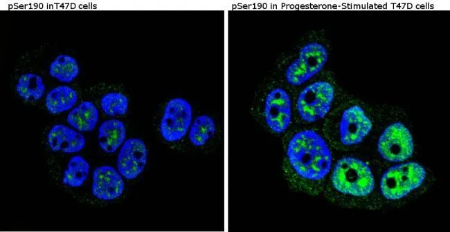 ICC/IF analysis of untreated T47D cells (left panel) or stimulated cells with 100 nM of Progesterone (right panel) using GTX30164 Progesterone Receptor (phospho Ser190) antibody [1154]. Green : Primary antibody Blue : Nuclei Fixation : Formalin Permeabilization : 0.1% Triton X-100 in TBS for 5-10 minute