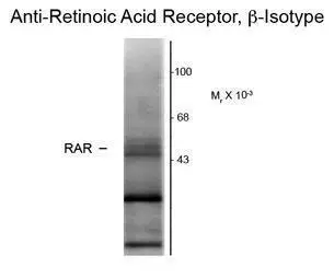 Western blot of rat hippocampal lysate showing specific immunolabeling of the ~48k RAR-beta isotype.