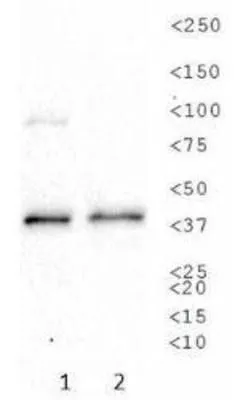 WB analysis of (1) SK-BR-3 and (2) A431 cell lysate using GTX30203 Sodium Potassium ATPase Beta 1 antibody [464.8(8A)].