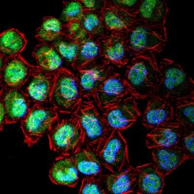 ICC/IF analysis of HeLa cells using GTX30232 CENPF antibody. Green : primary antibody Red : Actin Blue : DAPI Dilution : 1:5