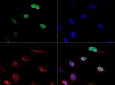 ICC/IF analysis of HeLa cells using GTX30232 CENPF antibody. Green : primary antibody Red : Tubulin Blue : DAPI