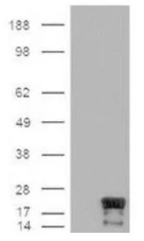 WB analysis of mock or overexpressing Survivin cell lysate using GTX30241 Survivin antibody [60.11].