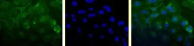 ICC/IF analysis of HeLa cells using GTX30241 Survivin antibody [60.11]. Green : primary antibody Blue : Hoechst 33258