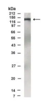 WB analysis of interleukin-1-stimulated 293 cell lysate using GTX30260 IKAP antibody. Dilution : 1:500 WB analysis of interleukin-1-stimulated 293 cell lysate using GTX30260 IKAP antibody. Dilution : 1:500
