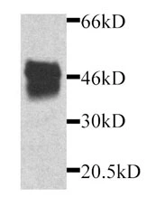 Western blot detection of GFP-MIP2 fusion protein in transfectant by anti-GFP. Western blot detection of GFP-MIP2 fusion protein in transfectant by anti-GFP.