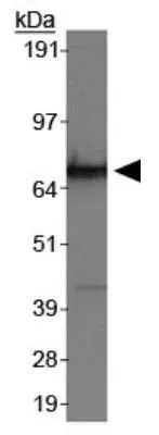 WB analysis of HeLa cell lysate using GTX30273 hnRNP M3-M4 antibody [2A6].