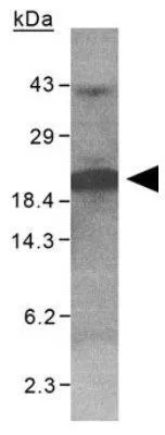 WB analysis of purified His-XAGE 1(100 microg) protein using GTX30362 XAGE1 antibody. WB analysis of purified His-XAGE 1(100 microg) protein using GTX30362 XAGE1 antibody.