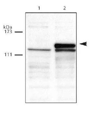 IHC-P analysis of human testis tissue using GTX30365 DNMT3A antibody.