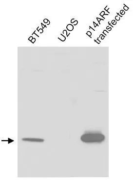 WB analysis of BT-549 (positive control), U2OS (negative control) and IMR90 overexpressing CDKN2A / p14ARF cell lysate using GTX30433 CDKN2A / p14ARF antibody. Loading : 25microg Dilution : 1 microg/ml WB analysis of BT-549 (positive control), U2OS (negative control) and IMR90 overexpressing CDKN2A / p14ARF cell lysate using GTX30433 CDKN2A / p14ARF antibody. Loading : 25microg Dilution : 1 microg/ml