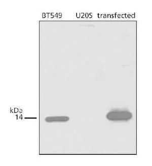 WB analysis of BT-549 (positive control), U2OS (negative control) and IMR90 overexpressing CDKN2A / p14ARF cell lysate using GTX30434 CDKN2A / p14ARF antibody. WB analysis of BT-549 (positive control), U2OS (negative control) and IMR90 overexpressing CDKN2A / p14ARF cell lysate using GTX30434 CDKN2A / p14ARF antibody.