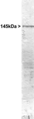 WB analysis of rat cerebellum tissue using GTX30441 NF-M antibody. WB analysis of rat cerebellum tissue using GTX30441 NF-M antibody.