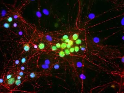 ICC/IF analysis of mixed neuron/glia cell cultures using GTX30441 NF-M antibody. Red : NF-M antibody Green : Fox1 antibody Blue : DAPI