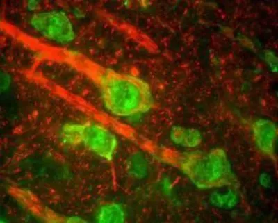 IHC-Fr analysis of rat cerebral cortex tissue using GTX30441 NF-M antibody. This immunostaining reveals the perikarya of pyramidal neurons and dendrites as well as axons surrounding the neurons. Red : primary antibody Green : beta-adrendergic receptor kinase 1 Dilution : 1:5000