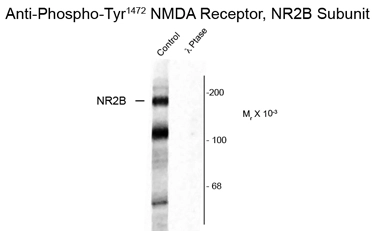 Western blot of rat hippocampal lysate showing specific immunolabeling of the ~180k NR2B subunit of the NMDAR phosphorylated at Tyr1472 (Control) using NDMAR2B (phospho Tyr1472) (GTX30452) antibody. Western blot of rat hippocampal lysate showing specific immunolabeling of the ~180k NR2B subunit of the NMDAR phosphorylated at Tyr1472 (Control) using NDMAR2B (phospho Tyr1472) (GTX30452) antibody.