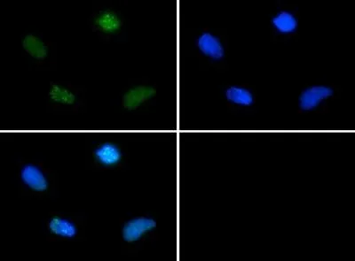 ICC/IF analysis of HeLa cells using GTX30488 Survivin (phospho Thr34) antibody. Green : primary antibody Blue : DAPI