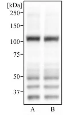 WB analysis of RAW264.7 (A),and RAW264.7 treated with 10uM T09 18 hr (B) cell lysate using GTX30598 ABCG1 antibody. Dilution : 2 ug/ml