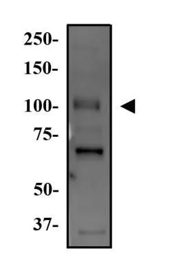 WB analysis of HEK293 cell lysate using GTX30604 WNK4 antibody. Dilution : 2 ug/ml