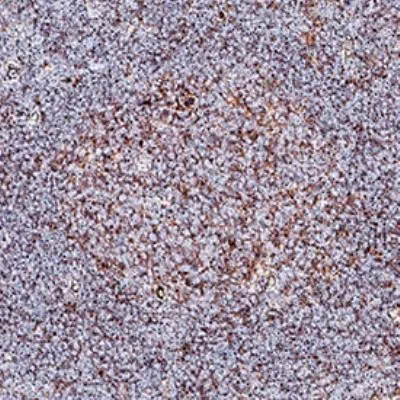 IHC-P analysis of human tonsil tissue using GTX30605 Blimp1 antibody. Dilution : 1:50 IHC-P analysis of human tonsil tissue using GTX30605 Blimp1 antibody. Dilution : 1:50