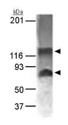 WB analysis of MCF-7 cell lysate using GTX30622 NABC1 antibody. Loading : 15microg Dilution : 1:1000 WB analysis of MCF-7 cell lysate using GTX30622 NABC1 antibody. Loading : 15microg Dilution : 1:1000