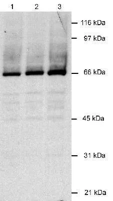 WB analysis of infected lysate using GTX30624 KSHV LANA2 antibody [CM-A807]. Lane 1: BCBL-1 cell(KSHV+) Lane 2: BC-1 cell(KSHV+/EBV+) Lane 3: BCP-1 cell(KSHV+) Loading : 30ug Dilution : 2 ug/ml