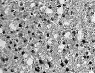 IHC analysis of rat brain tissue using GTX30646 HIF1AN antibody.