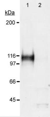 ICC/IF analysis of RCC4 cells using GTX30647 HIF1 alpha antibody. Green : primary antibody Blue : Hoechst 33258