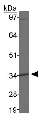 WB analysis of MDA-MB-231 cell lysate using GTX30648 DLX4 antibody. WB analysis of MDA-MB-231 cell lysate using GTX30648 DLX4 antibody.