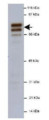 WB analysis of A431 cell lysate using GTX30689 NUMB antibody. Dilution : 0.5 microg/ml Loading : 20microg WB analysis of A431 cell lysate using GTX30689 NUMB antibody. Dilution : 0.5 microg/ml Loading : 20microg