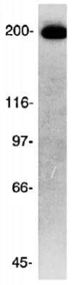 WB analysis of HeLa cell lysate using GTX30693 CKAP5 antibody. WB analysis of HeLa cell lysate using GTX30693 CKAP5 antibody.