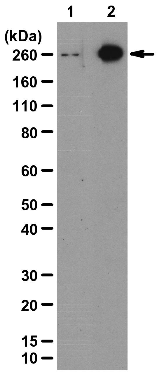 WB analysis of lysates from Lambda phosphatase-treated (lane 1) or untreated (lane 2) A375 cells using GTX30764 Acetyl-CoA Carboxylase 1 (phospho Ser79) antibody. Dilution : 1:500
