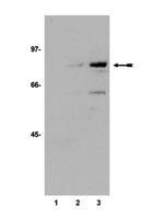 WB analysis of in vitro acetyl transferase reaction products using GTX30768 p53 (acetyl Lys373) antibody.Arrow indicates acetylated GST-p53. Lane 1 : GST-p53 alone Lane 2 : GST-p53 in the presence of PCAF Llane 3: GST-p53 in the presence of p300 Dilution : 1:1000 WB analysis of in vitro acetyl transferase reaction products using GTX30768 p53 (acetyl Lys373) antibody.Arrow indicates acetylated GST-p53. Lane 1 : GST-p53 alone Lane 2 : GST-p53 in the presence of PCAF Llane 3: GST-p53 in the presence of p300 Dilution : 1:1000