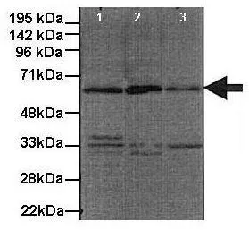 WB analysis of human HeLa, mouse NIH3T3, and human IHKE1 cells using GTX30781 GDI1 antibody at 1:1000. Lane1: HeLa lysate Lane2: NIH3T3 lysate Lane3: IHKE1 lysate