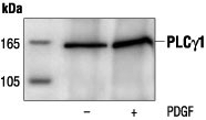 IP analysis of untreated or PDGF-stimulated NIH3T3 cell lysate using GTX30787 PLCG1 antibody. IP analysis of untreated or PDGF-stimulated NIH3T3 cell lysate using GTX30787 PLCG1 antibody.