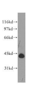 Western blot analysis in HeLa cell extract using GTX30809 (TARDBP antibody) at a dilution of 1:1200