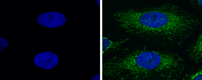 Fluoroshield? with DAPI is an aqueous mounting medium for preserving fluorescence of tissue and cell smears. This mounting medium is fortified with DAPI which is a counterstain for DNA.