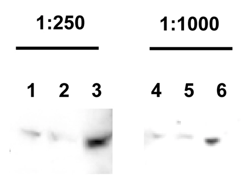 The Parkin antibody was tested to detect Parkin levels in stable Hek cells expressing Parkin. Antibody dilutions: 1:250 and 1:1000 Hek cell lysate used: 50ug (lanes 1 &4); 100 ug (lanes 2&5); 200ug (lanes 3&6). The Parkin antibody was tested to detect Parkin levels in stable Hek cells expressing Parkin. Antibody dilutions: 1:250 and 1:1000 Hek cell lysate used: 50ug (lanes 1 &4); 100 ug (lanes 2&5); 200ug (lanes 3&6).