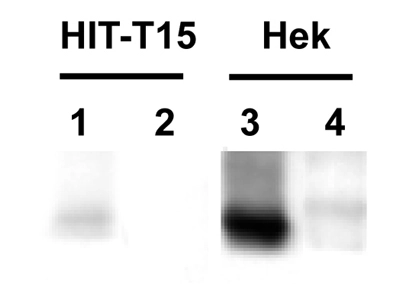 The Parkin antibody was tested to pulldown enodgenously expressed Parkin in HIT-T15 cells (Lane 1, HIT-T15 cells; Lane 2, negative control) and transiently transfected Parkin in Hek cells (Lane 2, Hek cells; Lane 4 negative control). Amount of antibody used: 4ug Lysate of cells used: 1000ug